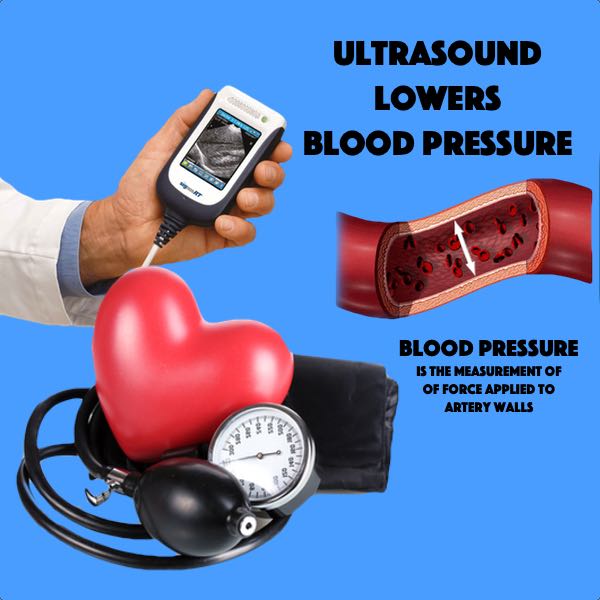 Ultrasound Lowers Blood Pressure